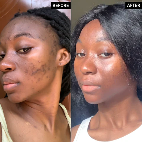 Before and after face results - Mrs Faith