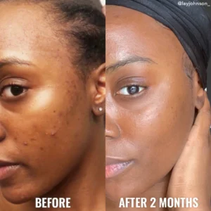 Customer before and after photo